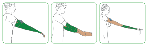 Arion Easy Slide - Arm - Image 2